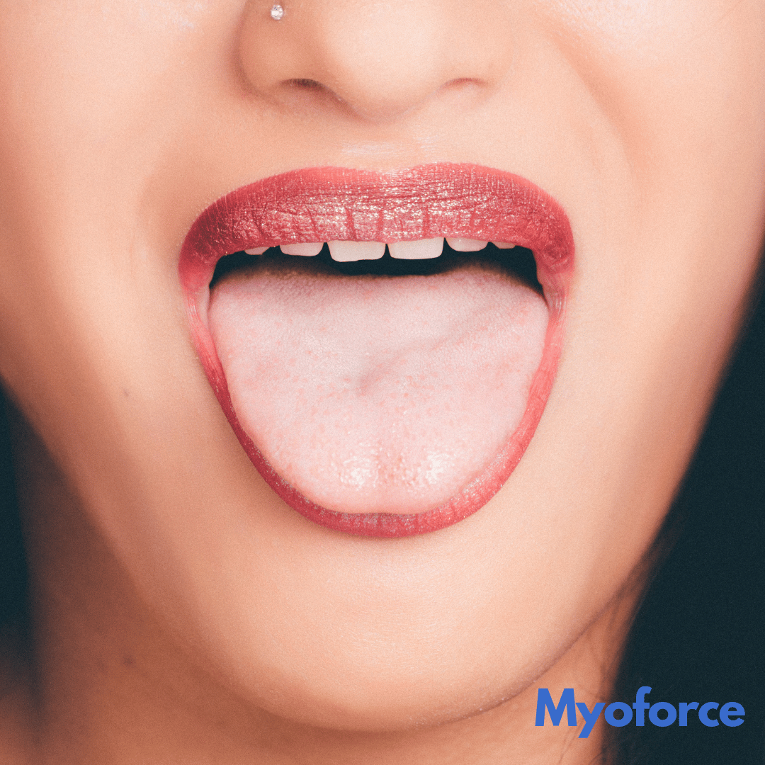 Resting tongue position: guidance and common questions