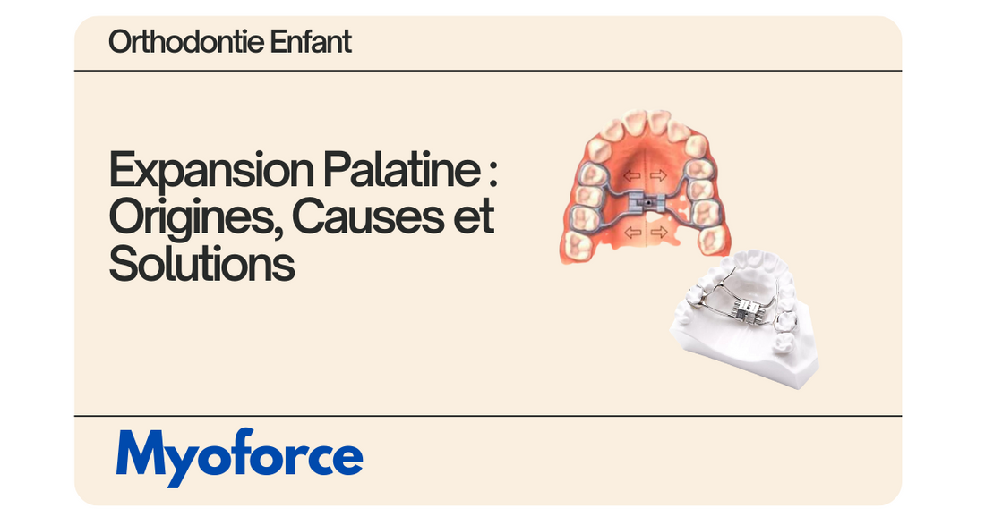 Expansion Palatine : Origines, Causes et Solutions