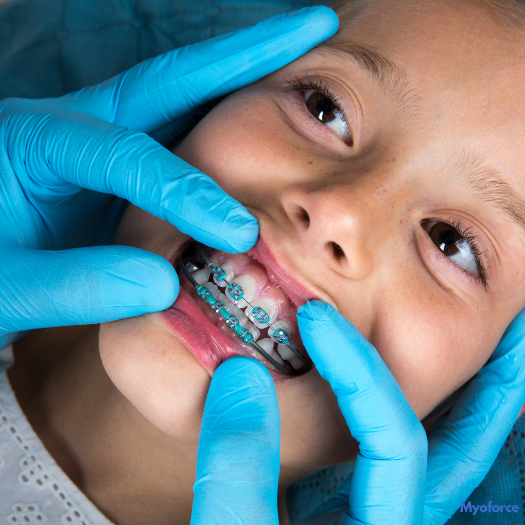 orthodontie-enfant-orthodontiste