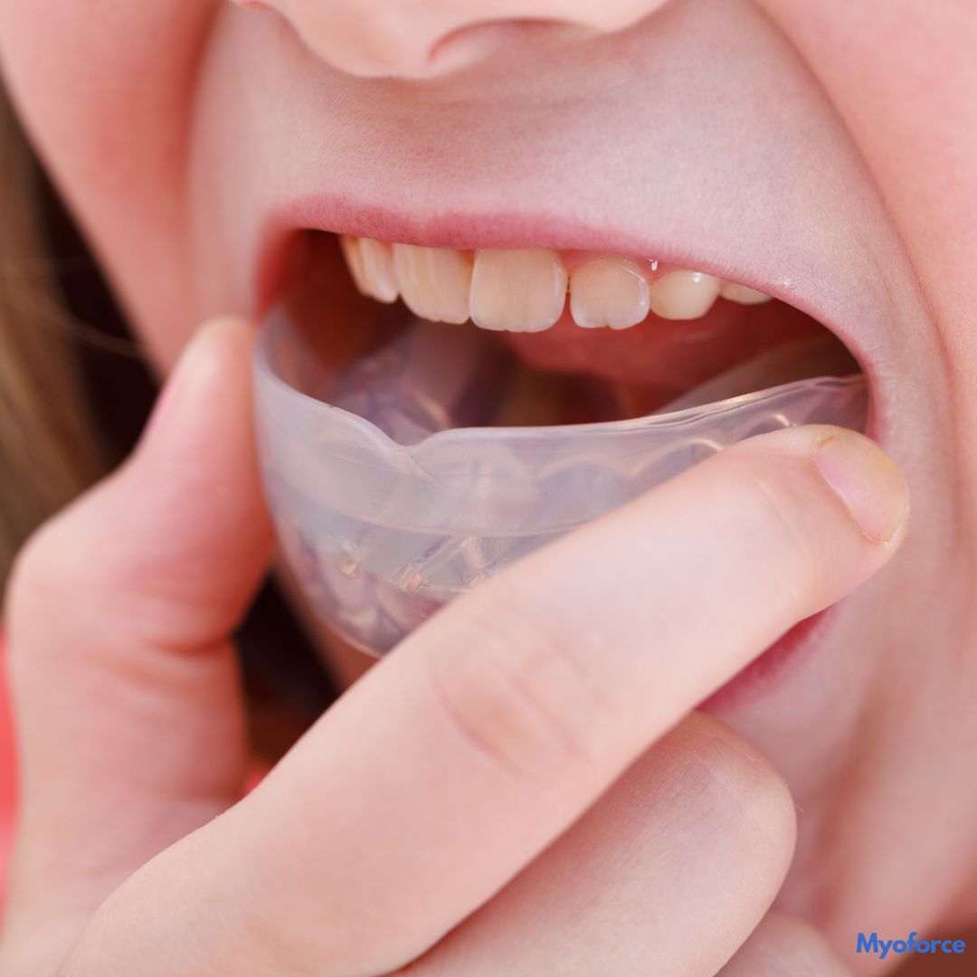 orthodontie-enfant-myoforce