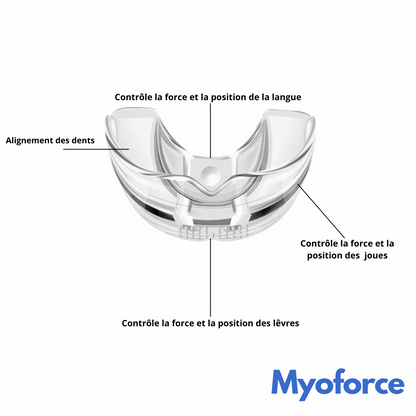 Gouttière Rééducation linguale Myoforce